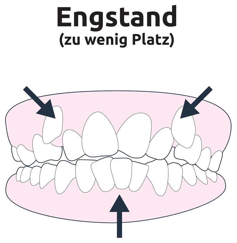 Engstand